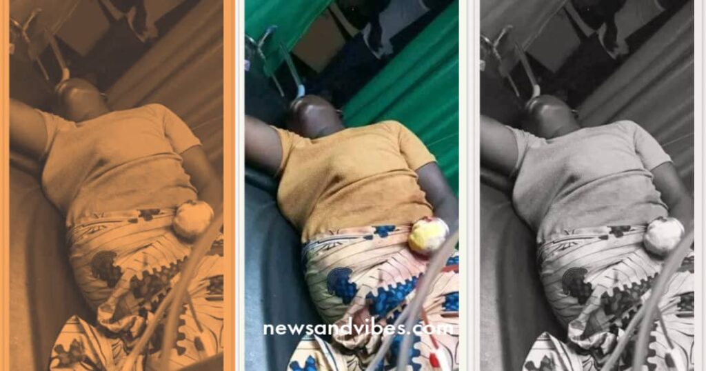 Poverty makes Nigerian man mutilate wife's hand for taking his GHC30