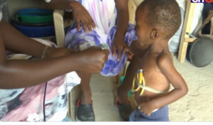 Video-2-year-old-abandoned-by-father-needs-GHS400k-for-life-saving-surgery.png