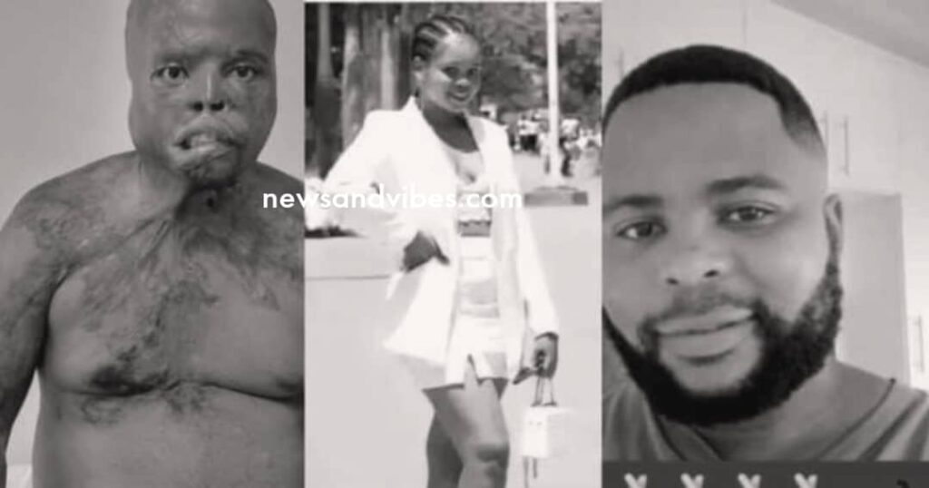 Lady pours acid on boyfriend over suspected cheating