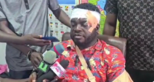 (Video) Student allegedly assaulted by Mahama's bodyguards speaks out