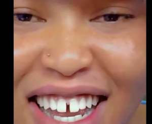 Woman's artificial gap tooth transformation sparks debate online