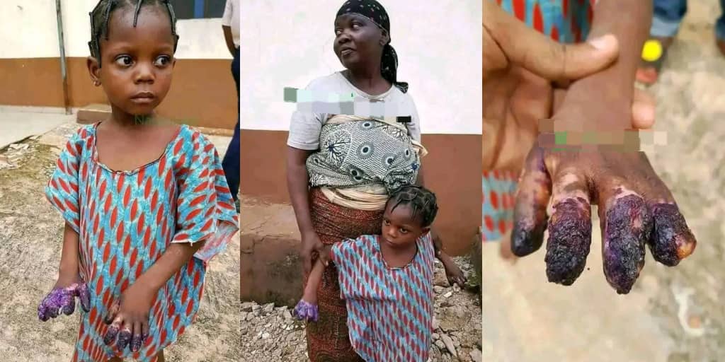 Woman Tortures Grandchild for Eating Noodles Without Permission
