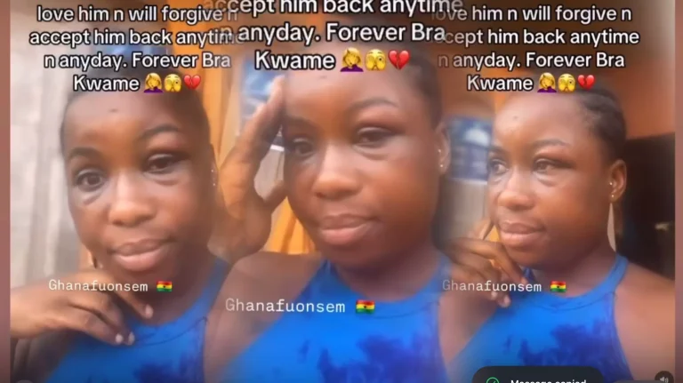 She Posted Her Injuries Online – But Says She’ll Never Leave Her Abusive Partner