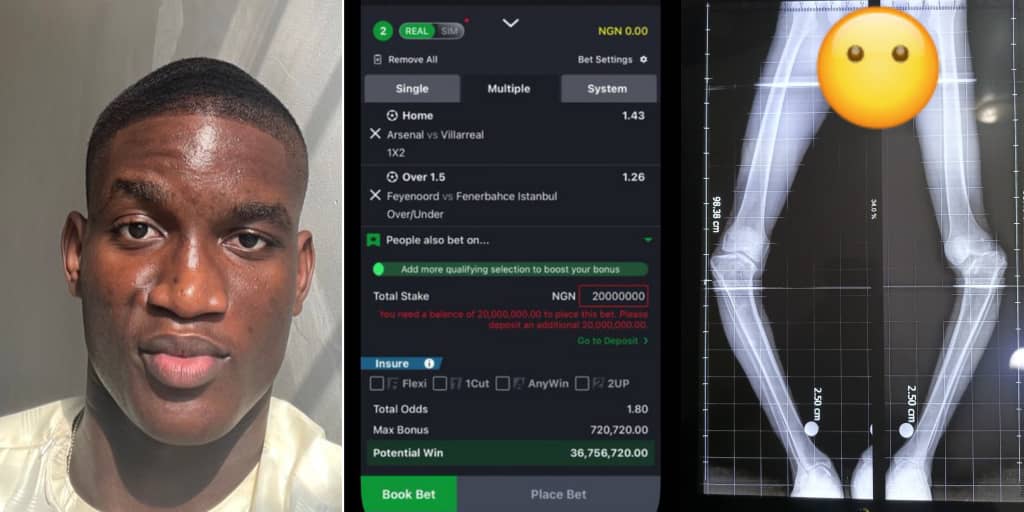 Man Raises Millions for Surgery—Then Gets Tempted to Gamble It All