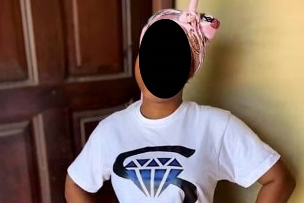 Murder Charges Loom as Acid Attack Victim Dies Months Later