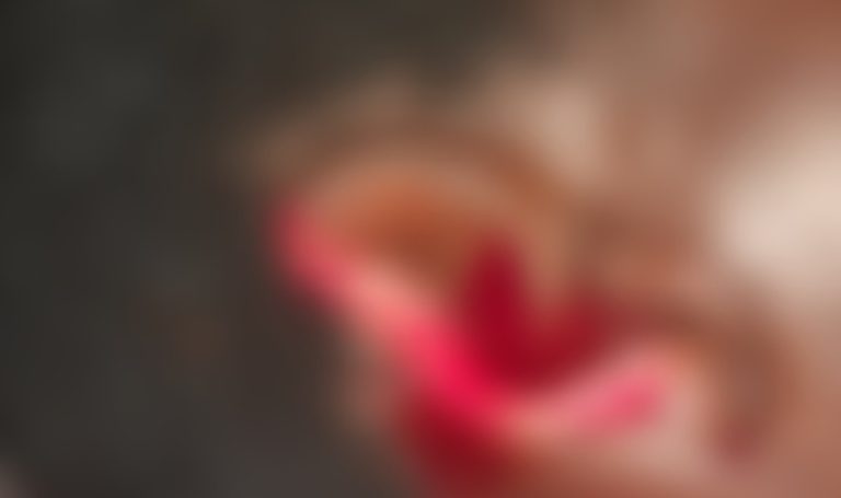 Man Allegedly Bites Off Wife’s Ear During Domestic Dispute