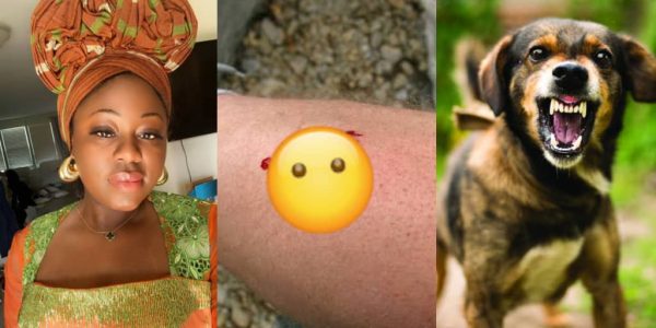 Dog Bite Turns Tragic Woman in U.S. Loses Leg After Infection