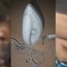 School Staff Accused of Burning 14-Year-Old Girl with Hot Iron Over Missing Money