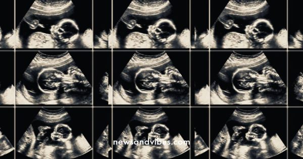 Lady confesses to having 18 abortions for her married boyfriend