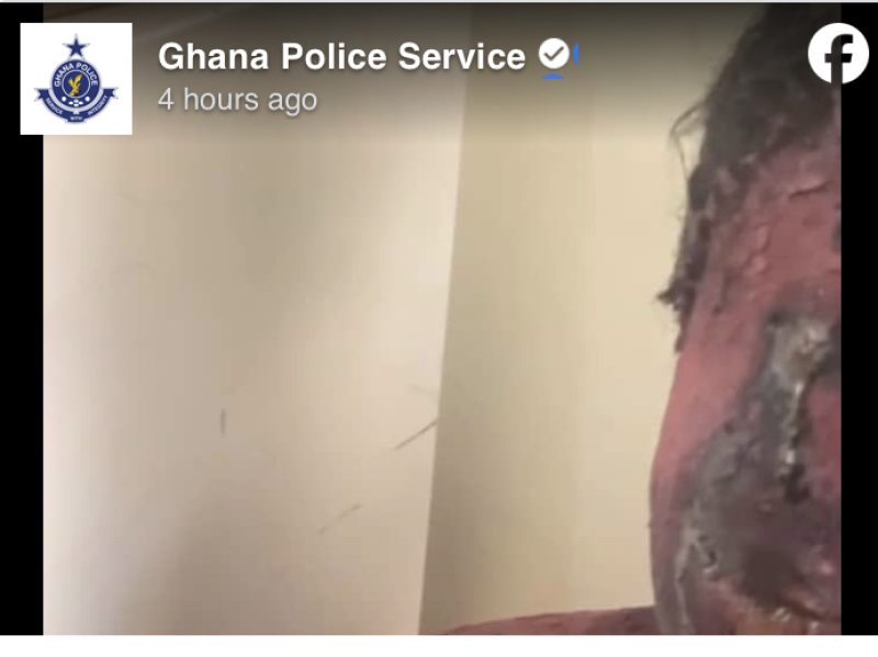 Female Constable Interdicted for Scalding Colleague with Boiling Water