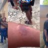 Landlord Defends Wife After She Allegedly Sinks Teeth into Tenant’s Arm