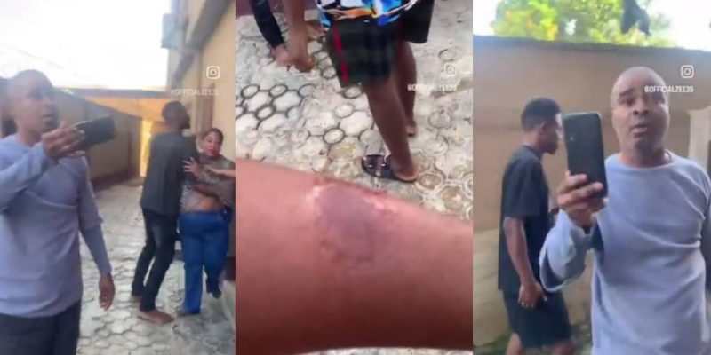 Landlord Defends Wife After She Allegedly Sinks Teeth into Tenant’s Arm