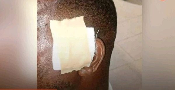 Soldier Bites Off Superior’s Ear