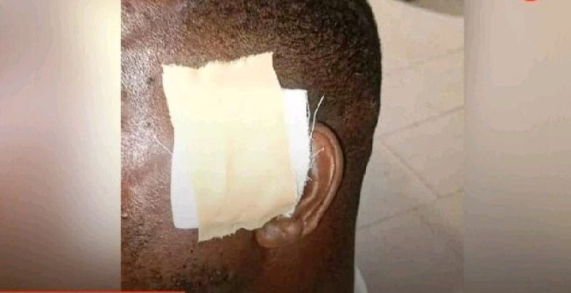Soldier Bites Off Superior’s Ear